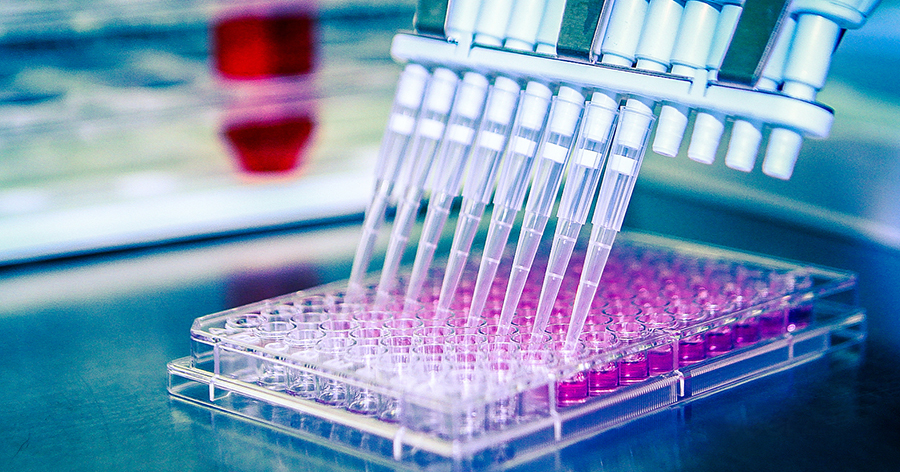 Mitkä ovat ELISA-sarjan toiminnot?